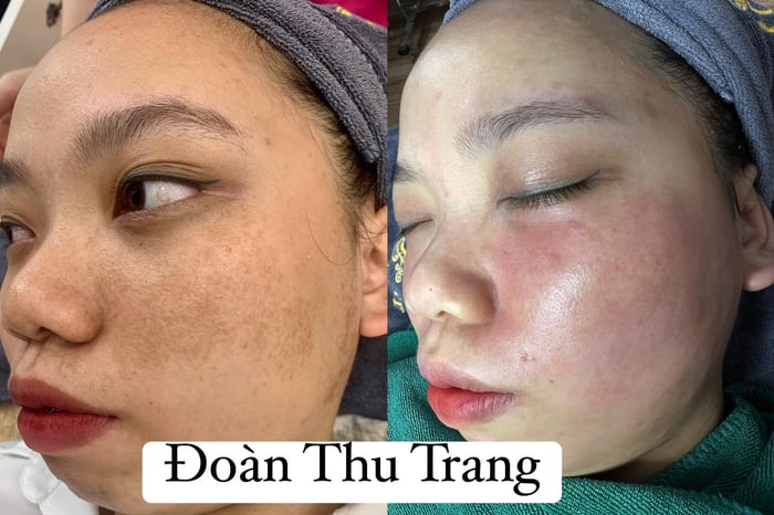 Hình ảnh 1 tại Trang Beauty Spa & Clinic