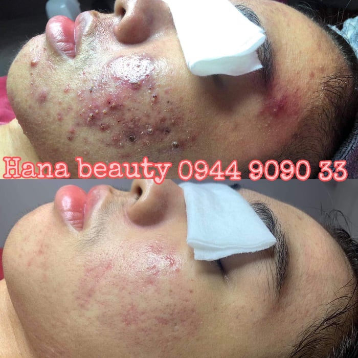 Hình ảnh HANA Beauty Spa & Cosmetic 3