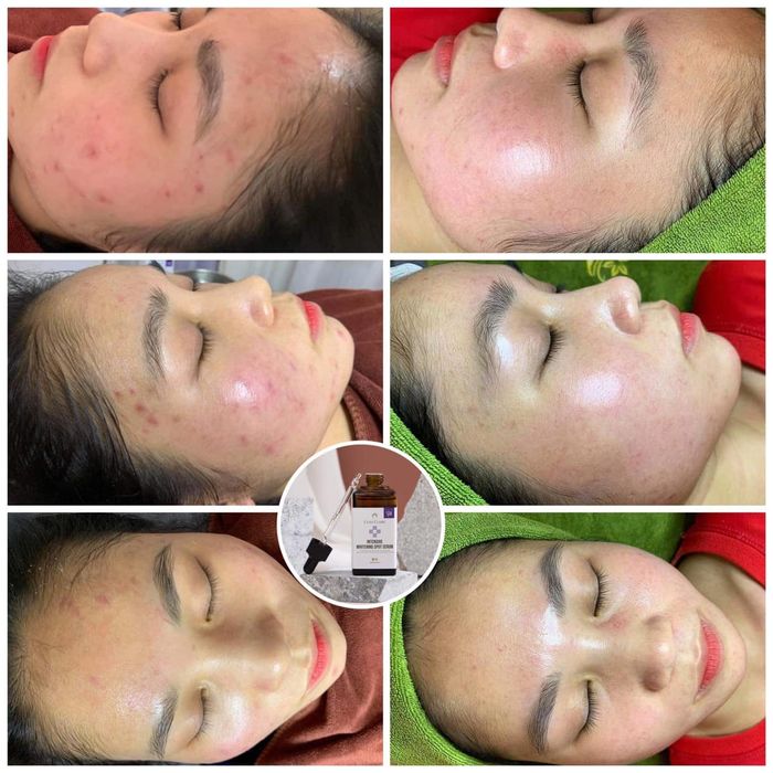 Hình ảnh Nấm Beauty số 2