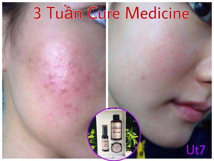 Hình ảnh Nấm Beauty 1