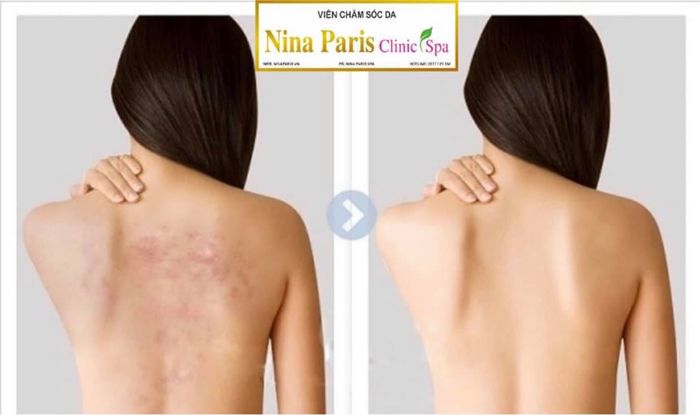 Hình ảnh của Nina Paris Spa 1