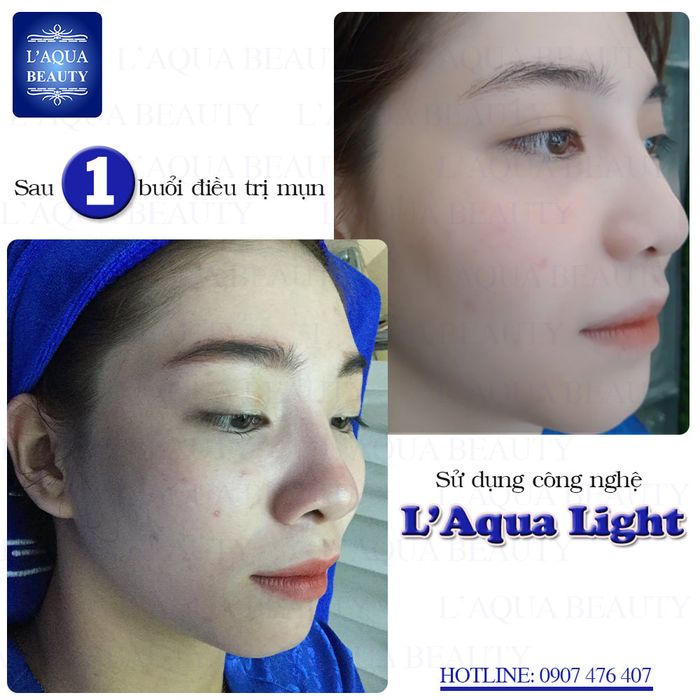 Hình ảnh 1 của L'Aqua Beauty