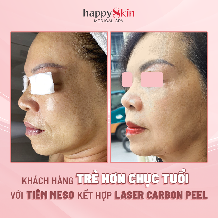 Ảnh 2 của Happy Skin Medical Spa