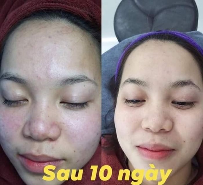 Hình ảnh 2 tại Vân Elly Spa & Clinic