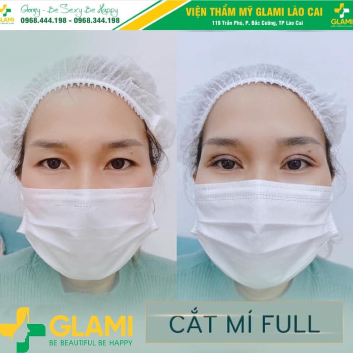 Ảnh Viện Thẩm Mỹ GLAMI 198+ 2