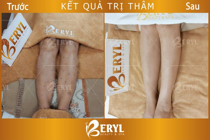 Hình ảnh 2 của Beryl Beauty & Spa