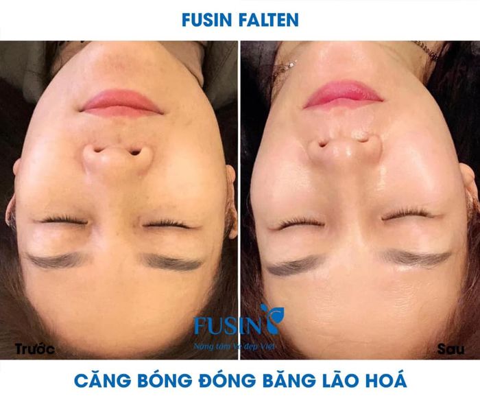 Hình ảnh 2 tại Evaspa Huyền Trang