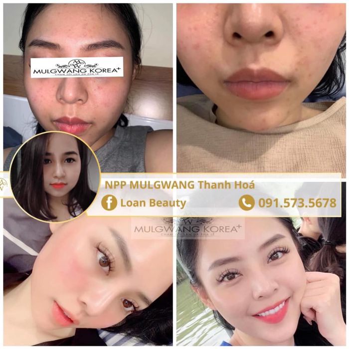 Hình ảnh 2 của Thẩm Mỹ CNC Loan Beauty SPA