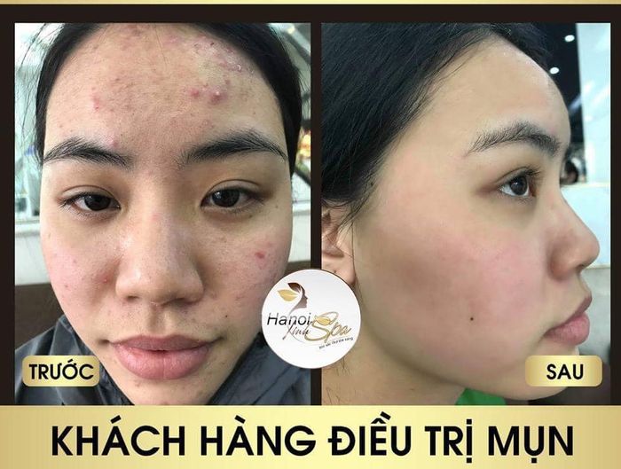 Hình ảnh 2 của Hà Nội Xinh Spa