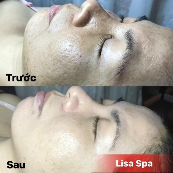 Hình ảnh của Anh Spa 2