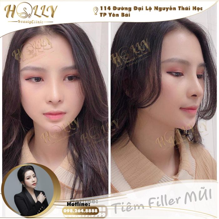 Hình ảnh 1 của HOLLY Beauty Clinic