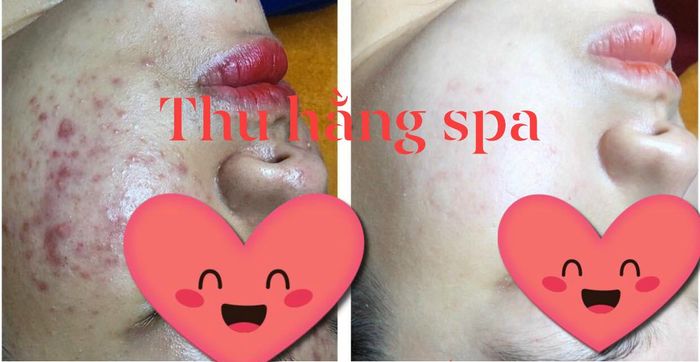 Ảnh Thu Hằng Spa 1