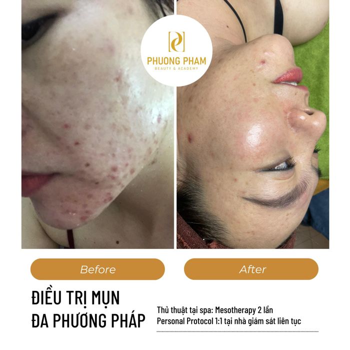 Hình ảnh 1 của Phương Phạm Beauty & Academy