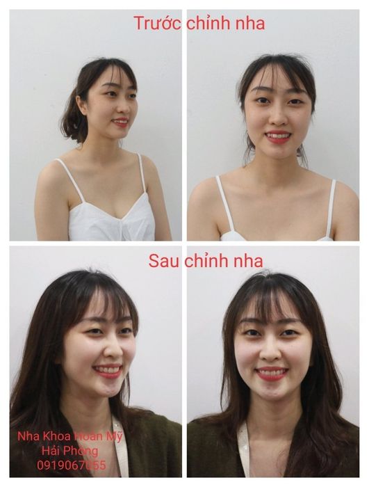 Nha Khoa Hoàn Mỹ Hải Phòng - Hình ảnh 1