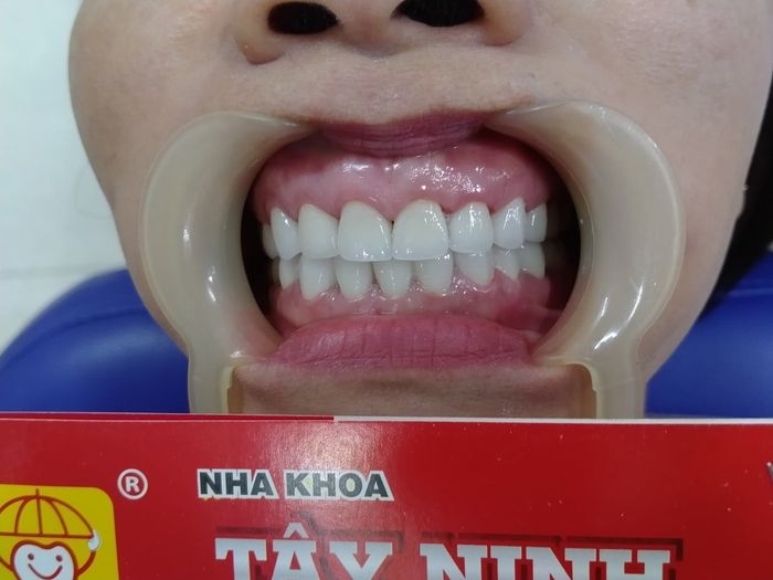 Ảnh 1 của NHA KHOA TÂY NINH