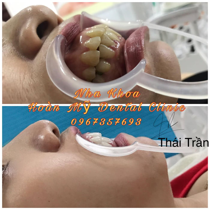 Hình ảnh Nha Khoa Hoàn Mỹ Dental 2