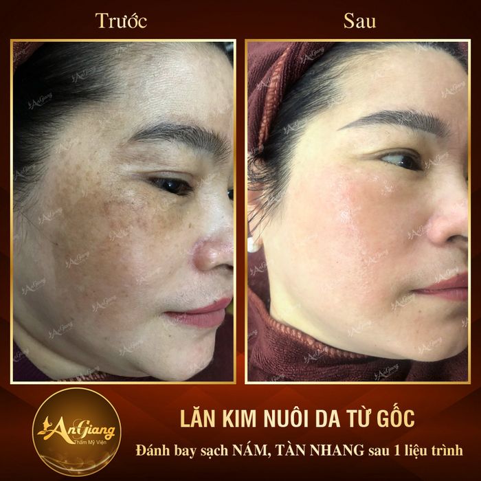 Hình ảnh 1 của An Giang Beauty & Spa