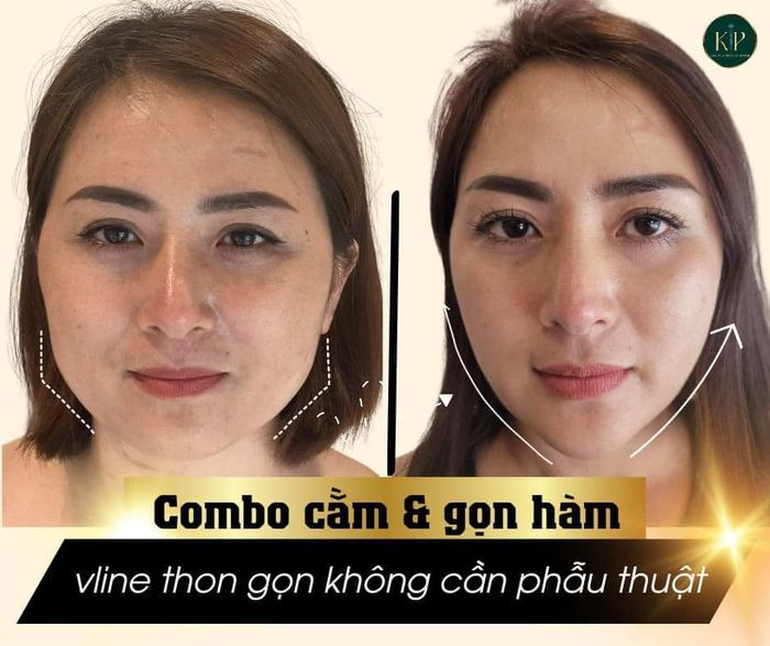 Ảnh Thẩm Mỹ Viện Kiều Phương 1