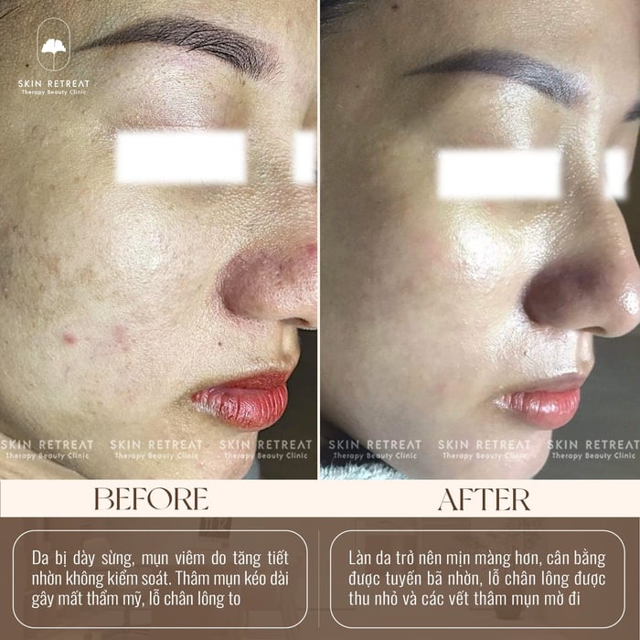 Ảnh của Skin Retreat 1