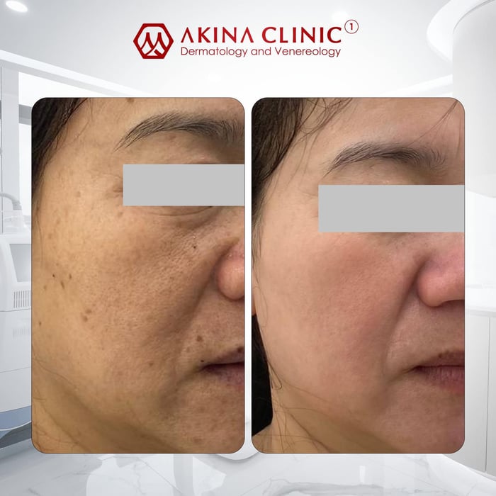 Hình ảnh 2 của Viện thẩm mỹ AKINA Clinic