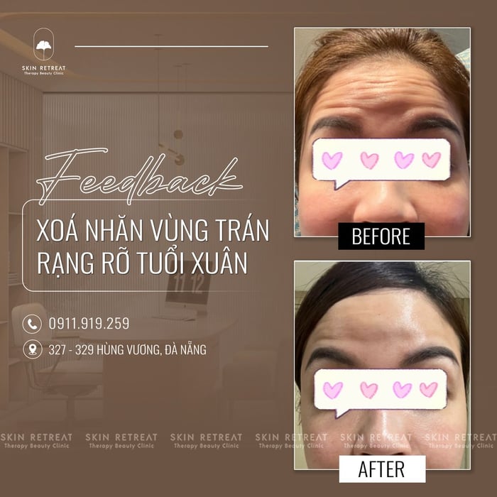 Ảnh của Skin Retreat 2