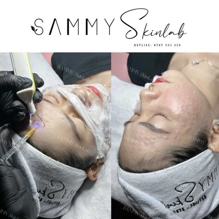 Hình ảnh Sammy Spa - Chi nhánh Rạch Giá 2