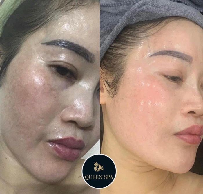 Hình ảnh Thẩm Mỹ Queen Spa - Kiên Giang 2