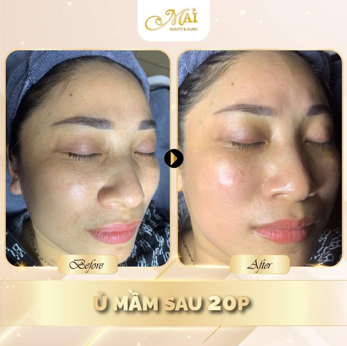 Hình ảnh của Mai Beauty & Clinic - 1