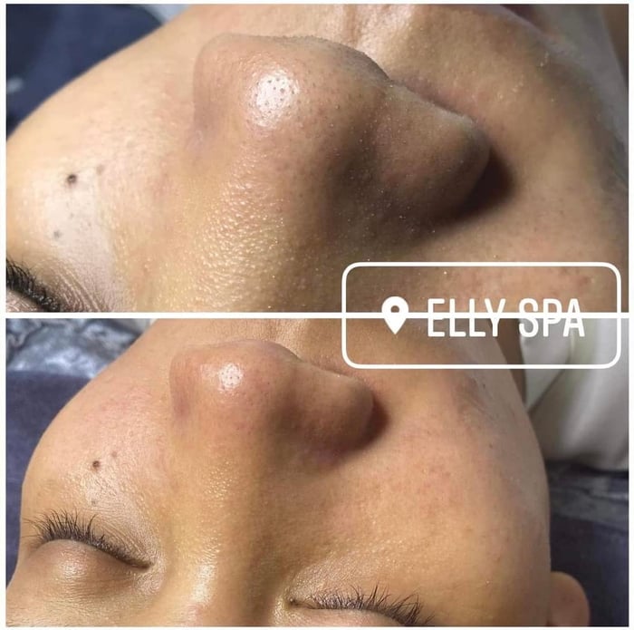 Hình ảnh ELLY SPA 2