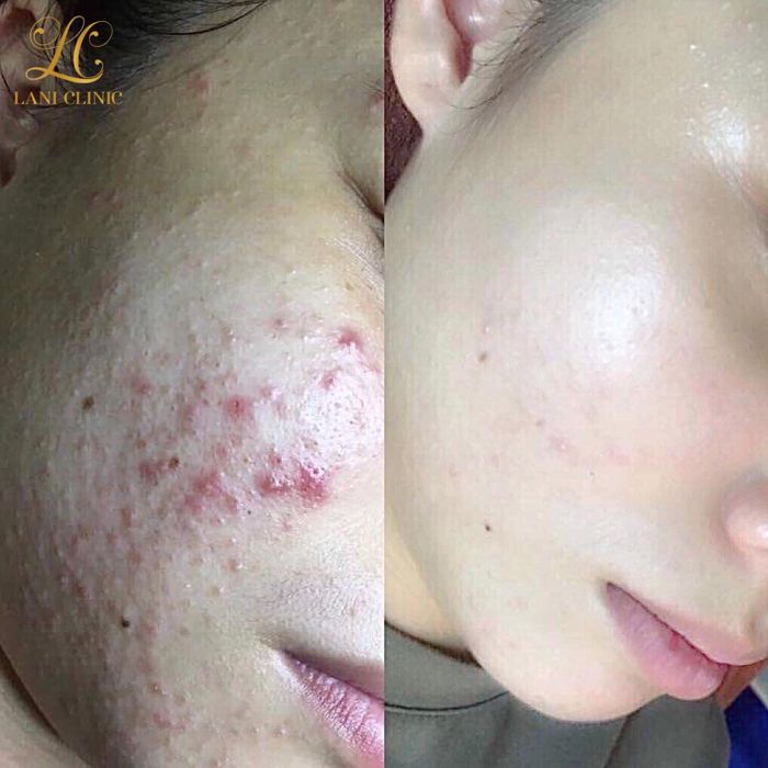Hình ảnh tại Lani Clinic - Beauty & Spa - 1