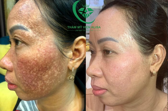 Hình ảnh Alisa Spa Cần Thơ 2