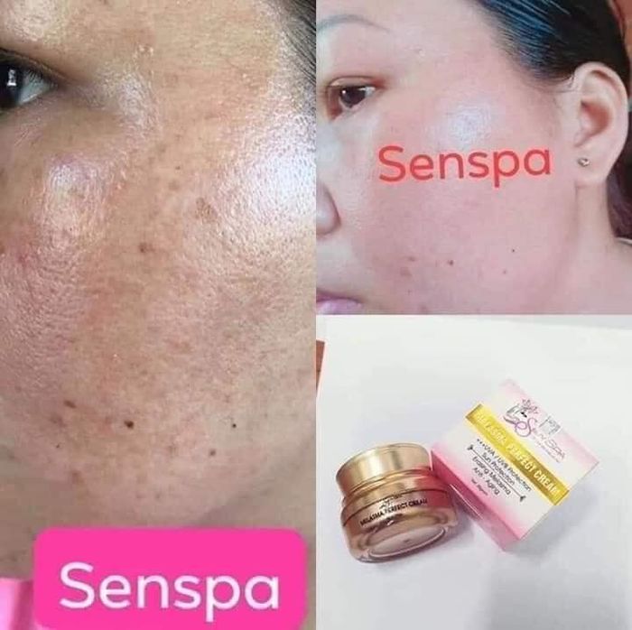 Hình Ảnh Sen Spa 2