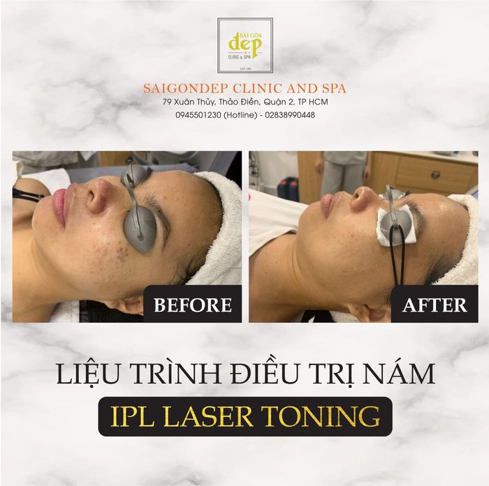 Hình Ảnh Trung Tâm Sài Gòn Đẹp Clinic & Spa 2