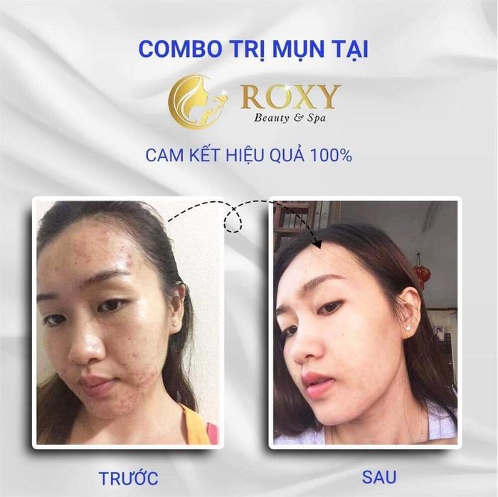 Hình Ảnh ROXY Spa 1