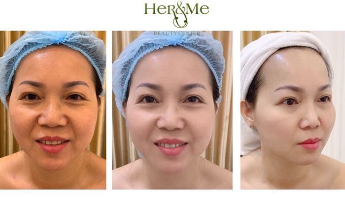 Hình Ảnh Trung Tâm Her&Me Beauty Center 2