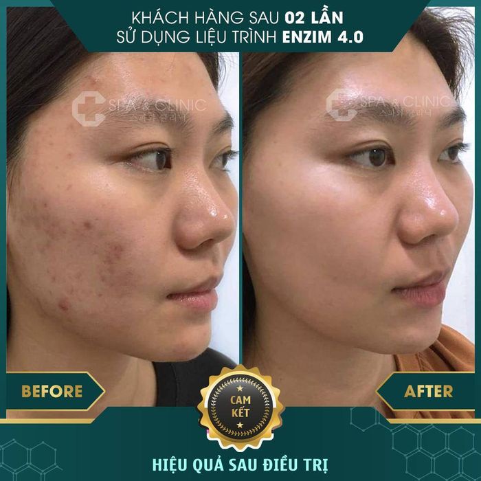 Hình ảnh 2 tại C Spa & Clinic