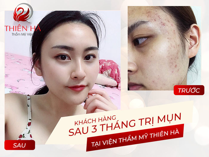 Viện Thẩm Mỹ Thiên Hà