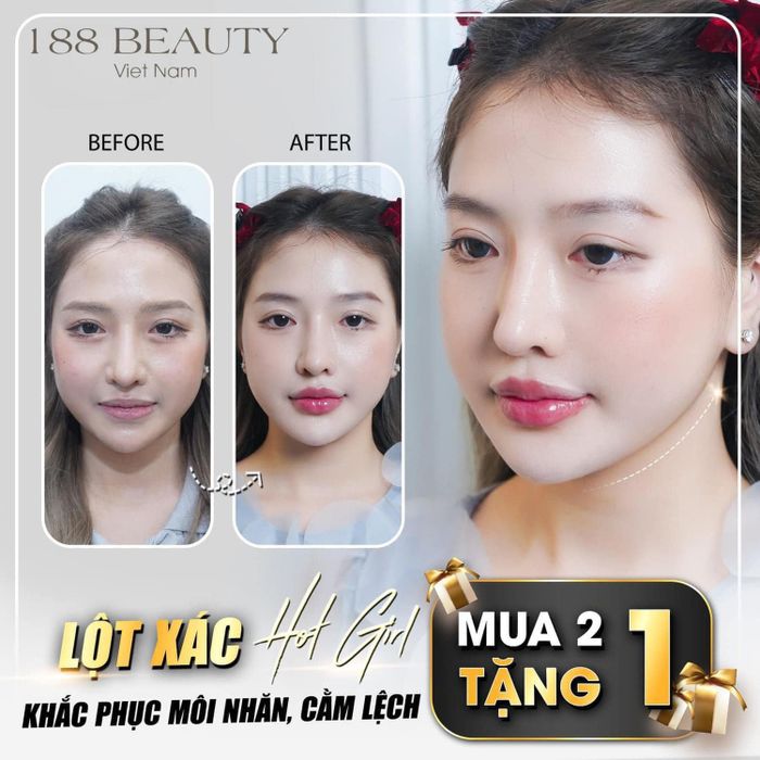 Hình ảnh Spa Shynh Beauty 2