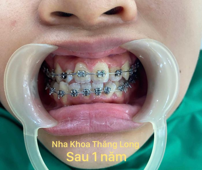 Hình ảnh Nha Khoa Thăng Long 2