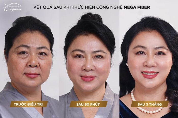 Mega Fiber