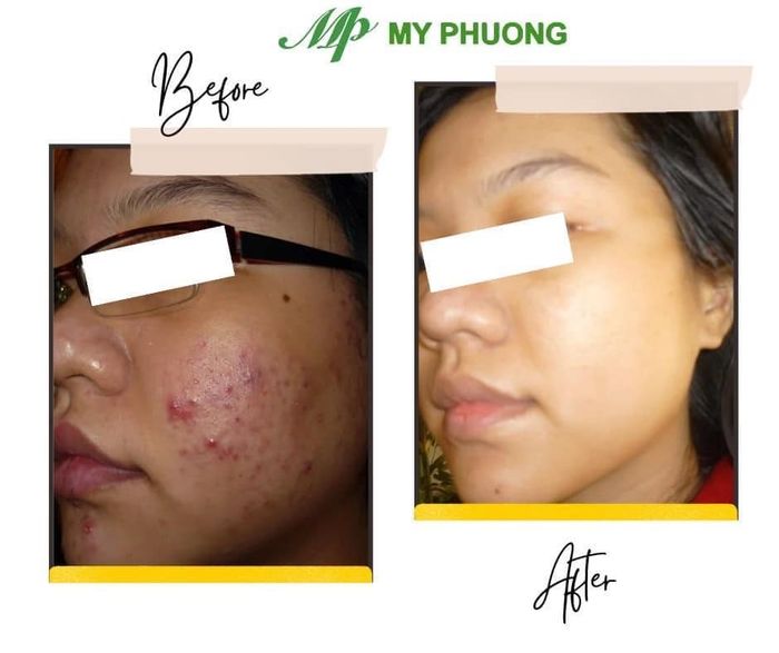 Spa Mỹ Phương - Hình ảnh 2