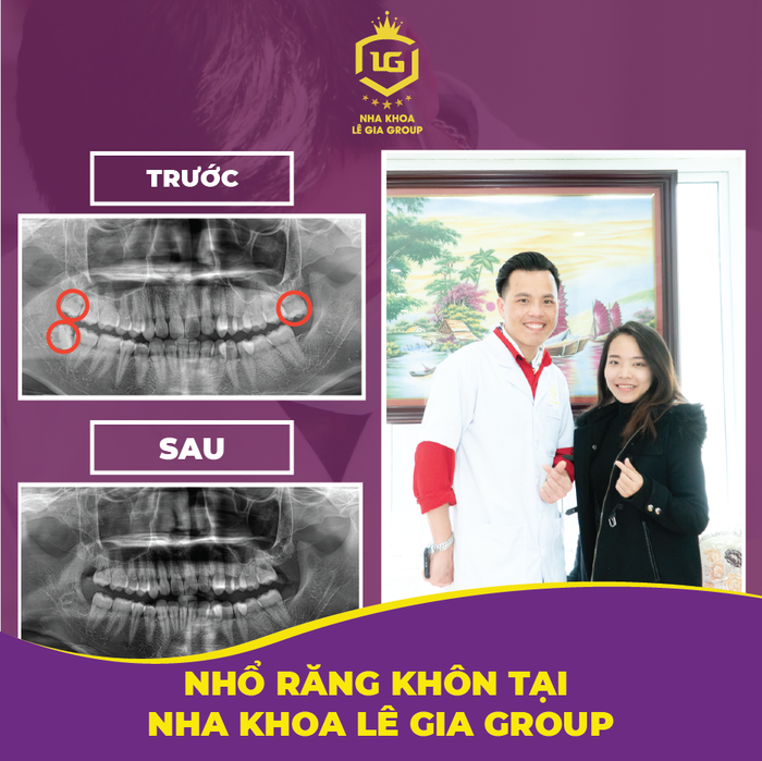 Ảnh 1 của Nha Khoa Lê Gia Group