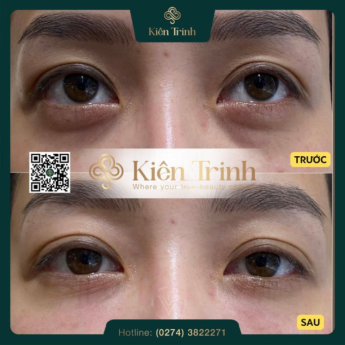 Hình ảnh Kiên Trinh Beauty Spa - Ảnh 2