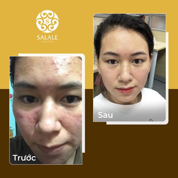 Hình ảnh 2 của Salale Clinic & Spa