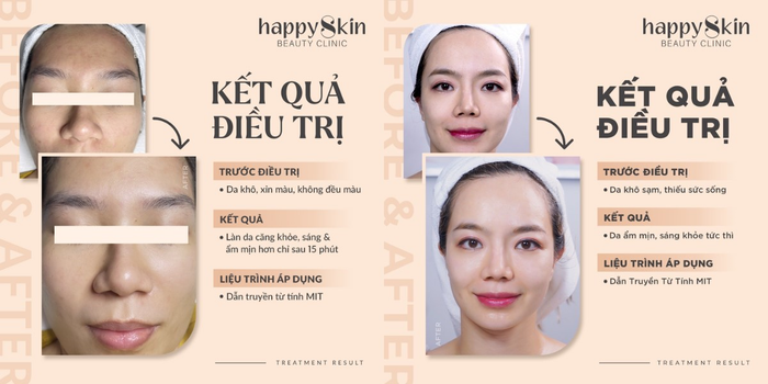 Hình ảnh 2 của Phòng khám làm đẹp Happy Skin