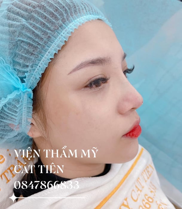 Hình ảnh 2 của Viện Thẩm Mỹ Cát Tiên