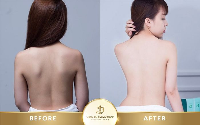 Ảnh 2 của Viện Thẩm Mỹ DIVA - Cần Thơ