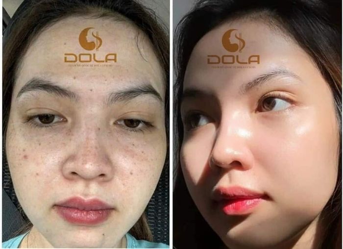 Ảnh 1 của DOLA Xinh Spa