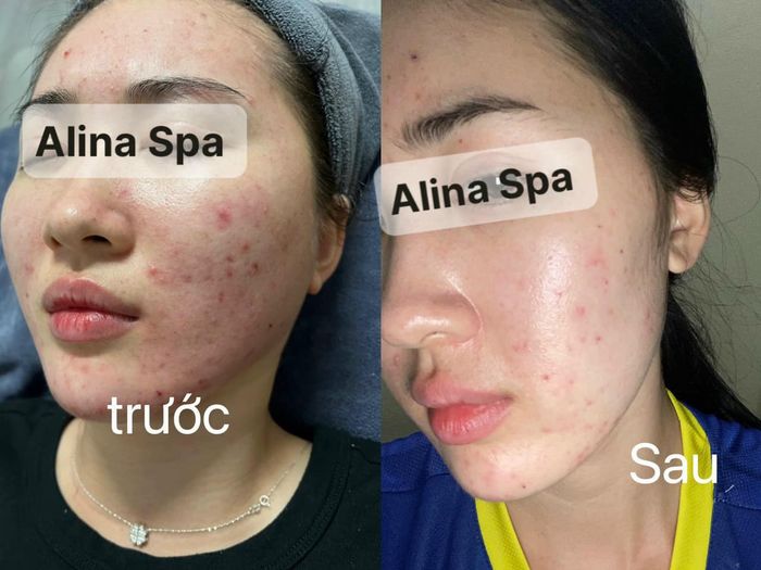 Hình ảnh ALina Spa 1