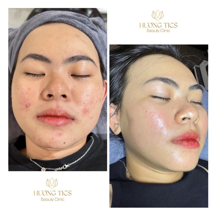 Ảnh 2 của Hương Tics Beauty Clinic